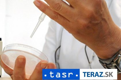 Slovaci v prestiznom casopise Ich inhibitor odhali virus